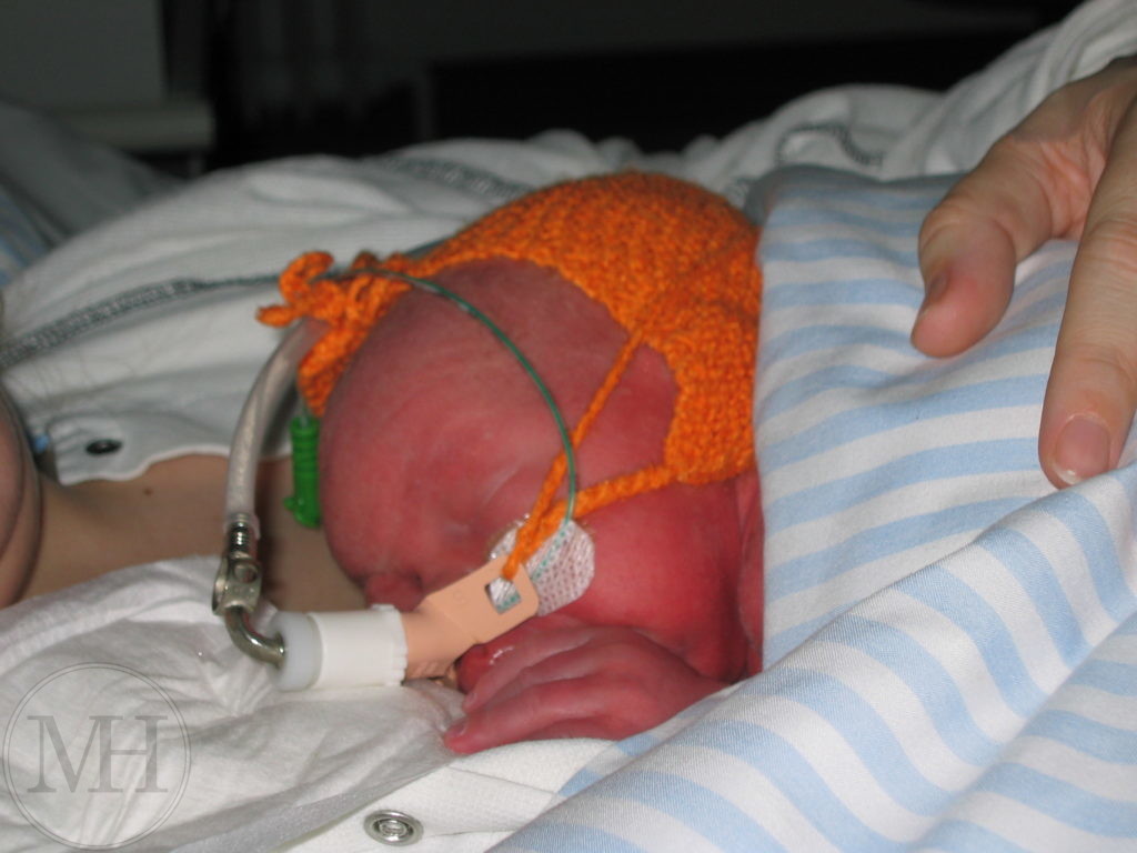 for tidligt født baby med CPAP